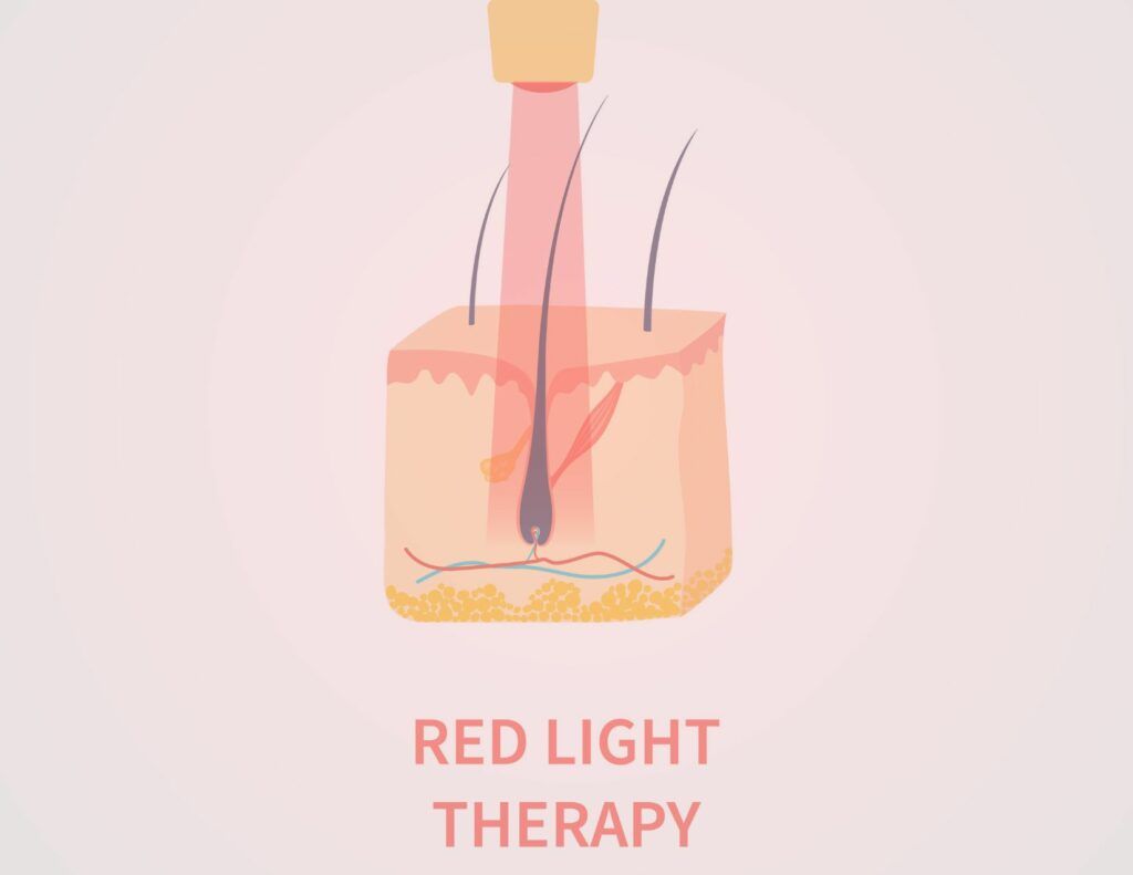 laser led light therapy hair regrowth