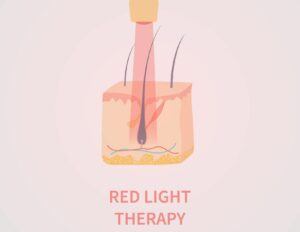 Low-Level Laser Light Therapy